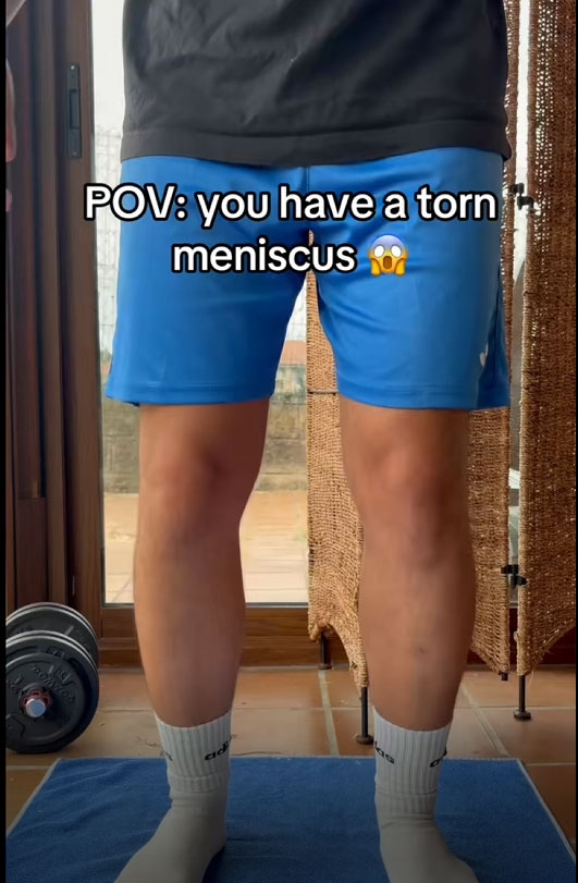 Person standing in blue shorts beside workout equipment with text reading, “POV: you have a torn meniscus.”